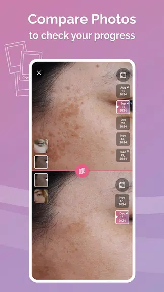 Schermata Skincare Routine: FeelinMySkin 2